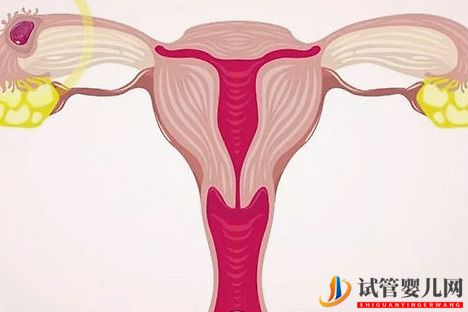 试管婴儿网:女性子宫内膜过薄对做试管婴儿有什么影响？(图1)