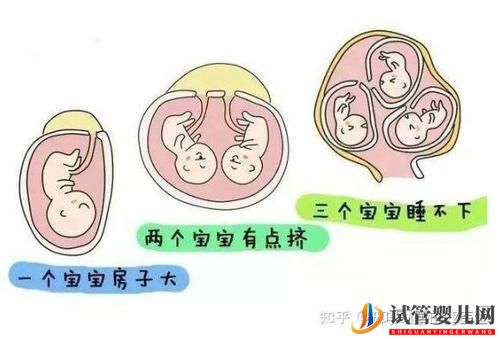 试管婴儿网:试管婴儿双胞胎成功率有多大有哪些风险(图7)