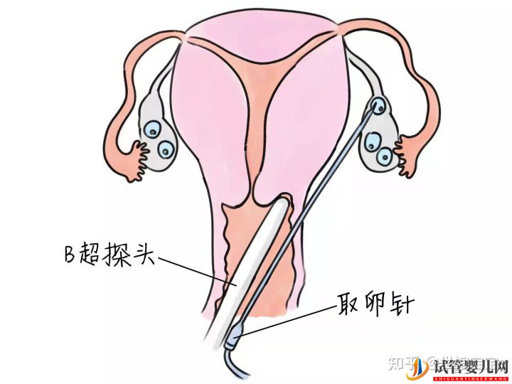 试管婴儿网:很多人说试管婴儿可能不会是自己亲生的,这是真的...(图1)