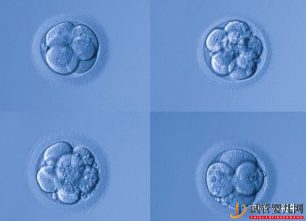 美国梦美HRC试管专家解析三代试管婴儿技术的优缺...（试管婴儿多少钱）(图5)