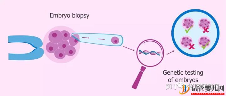 关于美国试管婴儿技术的问题一网打尽（试管婴儿多少钱）(图8)