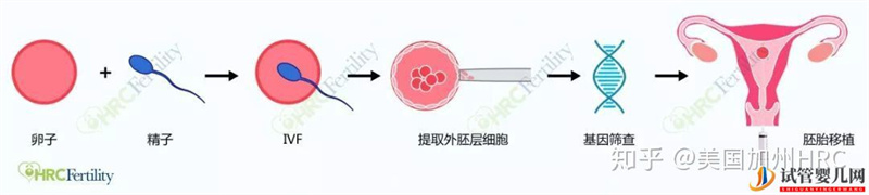 要去美国看病别怕!小C带您全面了解美国试管婴儿...（试管婴儿多少钱）(图49)