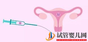 泰国三代试管生男孩可以健康活到几岁广州试管告诉...(图2)