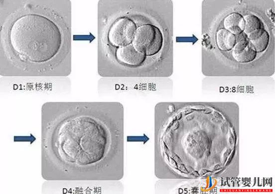 中美试管婴儿的差异在哪里（试管婴儿多少钱）(图5)