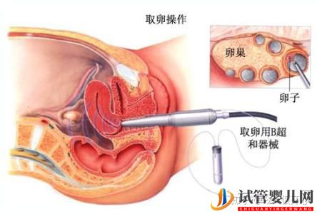 干货分享——泰国试管婴儿详细流程攻略(图9)