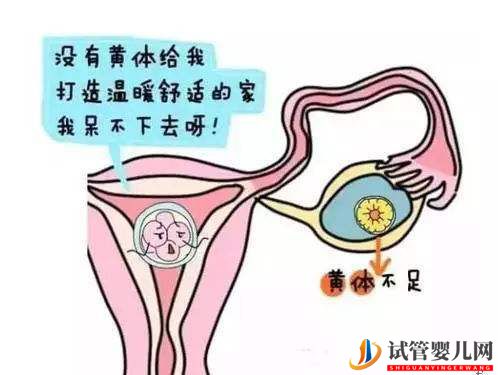 女性黄体功能不全可以选择试管婴儿吗(试管婴儿费用大概要多少钱)(图1)