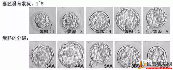 囊胚级别划分,什么级别的囊胚成功率最...(试管婴儿费用大概要多少钱)(图9)
