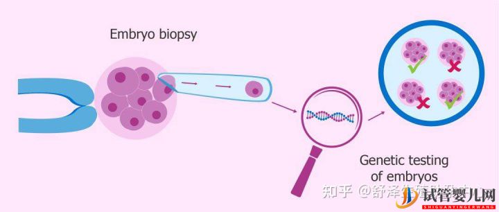 做试管孩子的性别可以随便选吗(试管婴儿费用大概要多少钱)(图1)