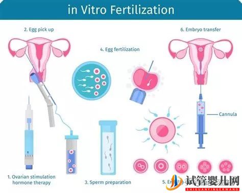 同性恋人赴美国试管婴儿应该做什么准备（试管婴儿多少钱）(图4)