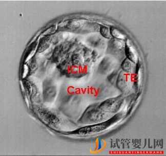 美国试管婴儿这样的囊胚才是极好的!（试管婴儿多少钱）(图1)