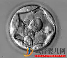 美国试管婴儿这样的囊胚才是极好的!（试管婴儿多少钱）(图15)