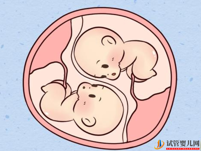 两枚胚胎会发育成双胞胎