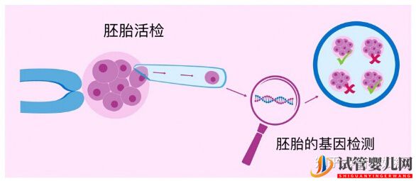 试管婴儿的利弊分析(试管婴儿费用大概要多少钱)(图1)