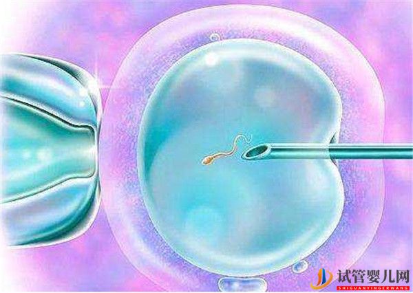 试管前如何评估卵巢功能提高试管成功率的方法有哪些(多囊卵巢能怀上孩子吗)(图1)