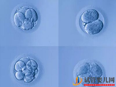 卵巢功能不好还能做试管婴儿吗_(多囊卵巢能怀上孩子吗)(图2)