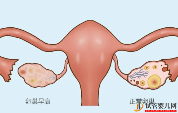 amh0.15是卵巢早衰