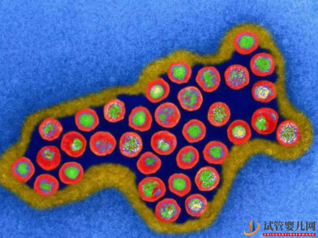 巨细胞病毒是一种疱疹病毒组DNA病毒