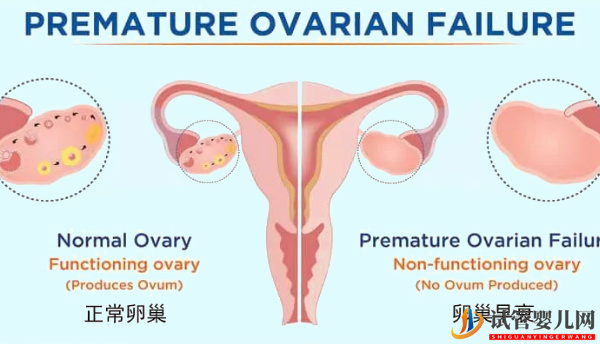 卵巢功能不好可以做试管