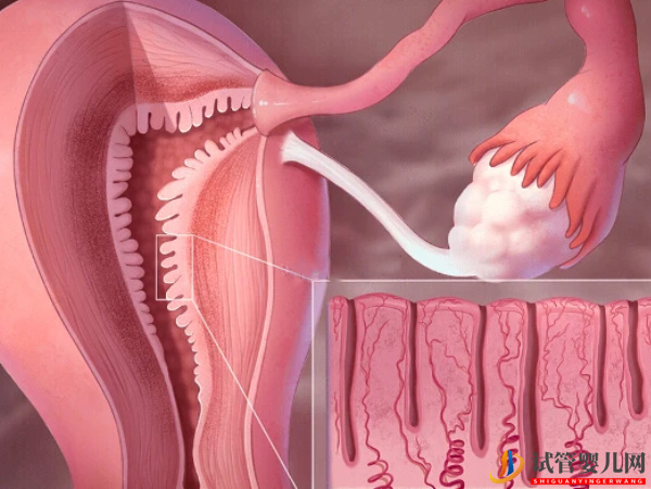 内膜偏厚偏薄都不利于移植