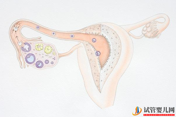 输卵管通而不畅做试管有影响