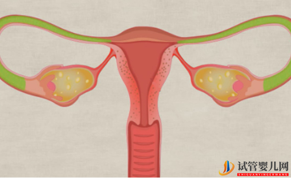 输卵管切除是可以做试管的