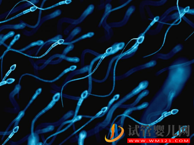 精子dna碎片率过高会导致不孕不育