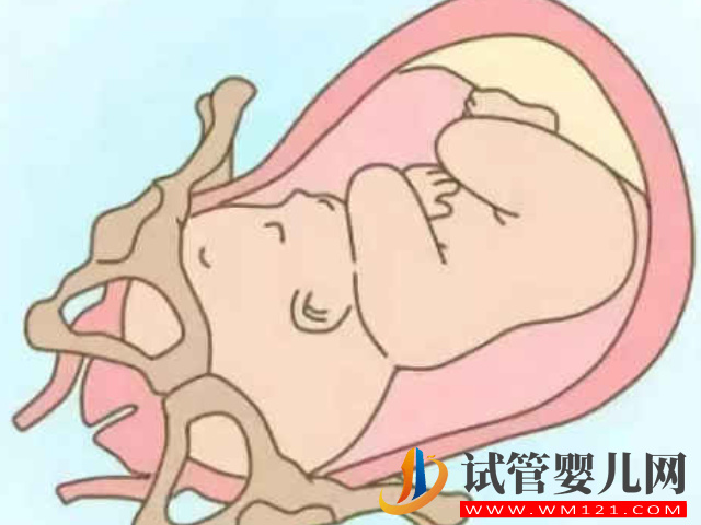 胎儿半入盆状态