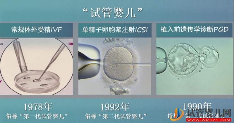 试管婴儿技术走到了哪一步？专家解答→(图7)