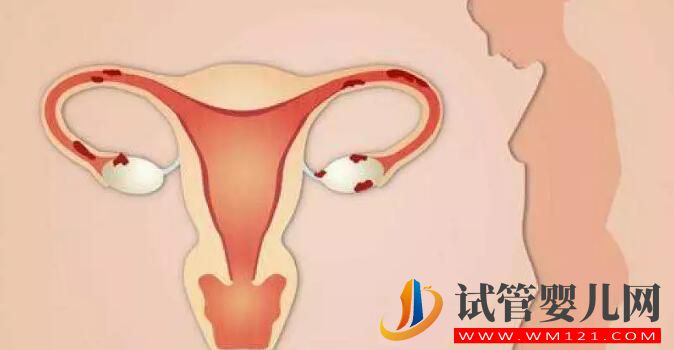 卵巢功能不好能做试管婴儿吗？这三点分析需明白！为你指明方向！
