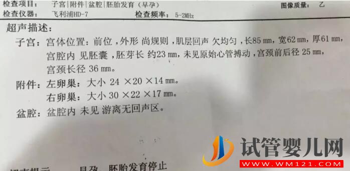 胎停育后能再次怀孕吗？不要等到发生再后悔,孕妈一定要看！