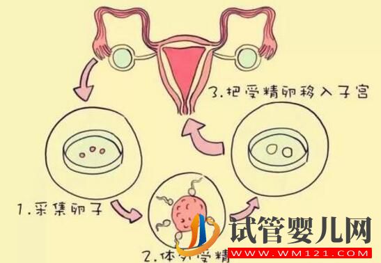 哪些因素影响试管婴儿移植的成功？这几种一定要注意，这样做才对！