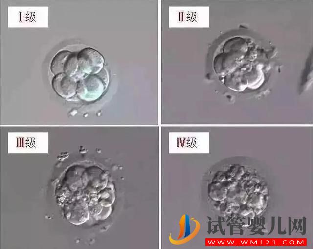 试管婴儿胚胎选择看“颜值”，长得好看才能被移植！