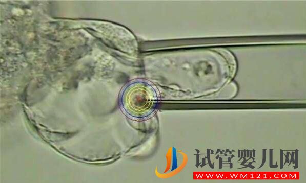 人工授精多次失败后还可以做试管婴儿吗?