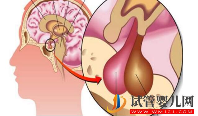 泌乳素高会影响做试管婴儿吗？如何比较好？