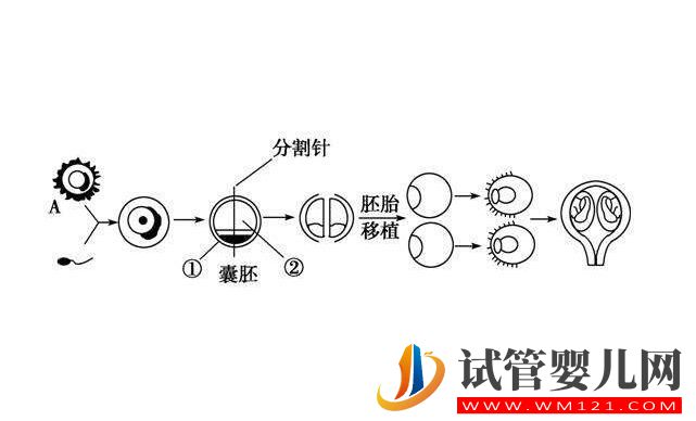 囊胚移植和普遍胚胎移植有什么区别？囊胚移植的优点是什么