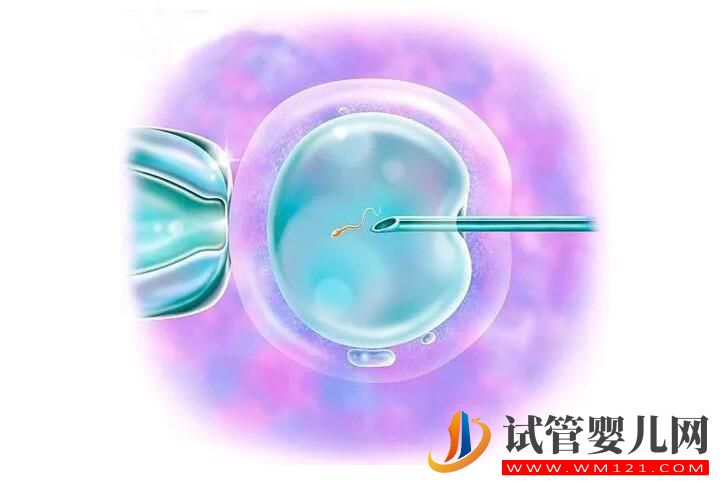 试管婴儿胚胎移植一个还是两个好