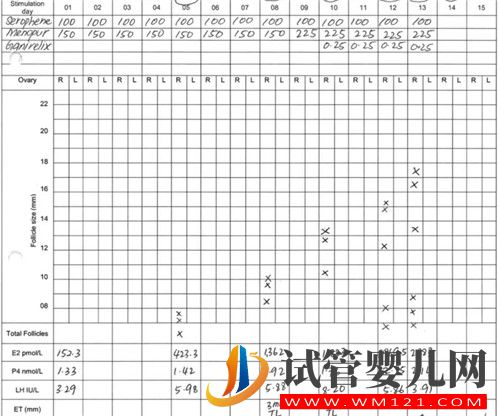 泰国试管婴儿