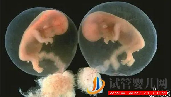 单卵双胎发生时间