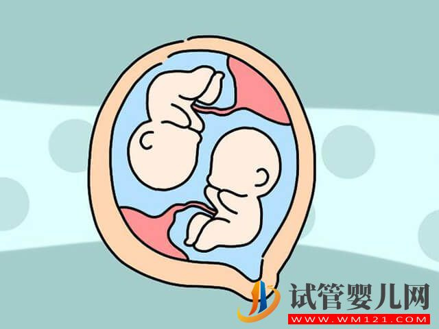 双胎生育
