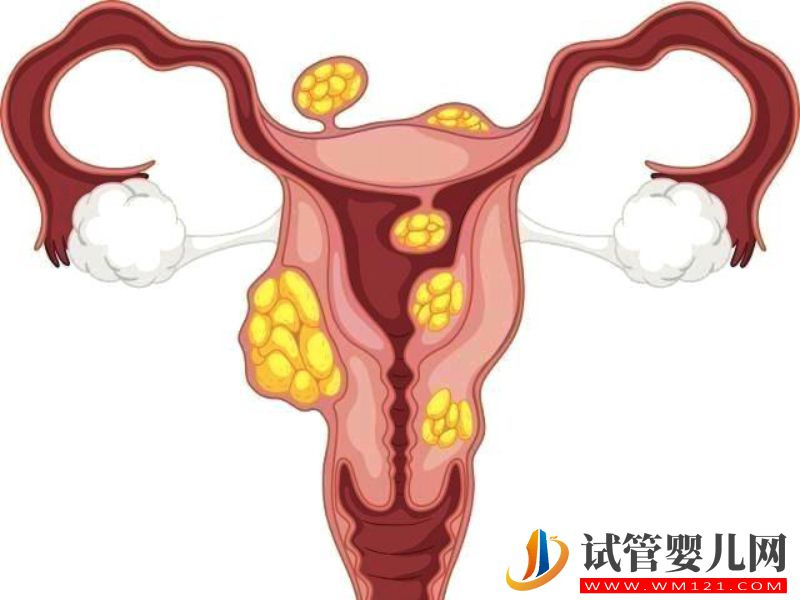 卵巢功能低下会降低怀孕概率