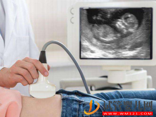 超声波扫描可以看胎儿是男是女