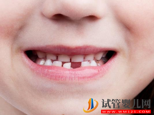从小孩换牙开始要时刻关注牙齿发育情况