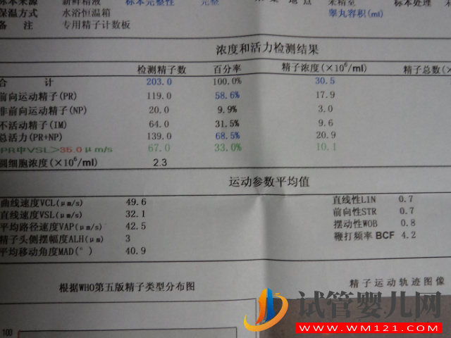 男性精子检查报告单