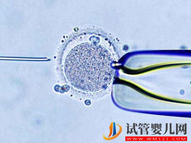 去香港做试管要要1至2个月的时间