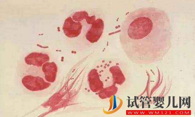 试管婴儿前期检查项目报告你看的懂吗?看完就会了(图5) 试管婴儿前期检查项目报告你看的懂吗?看完就会了(图5)