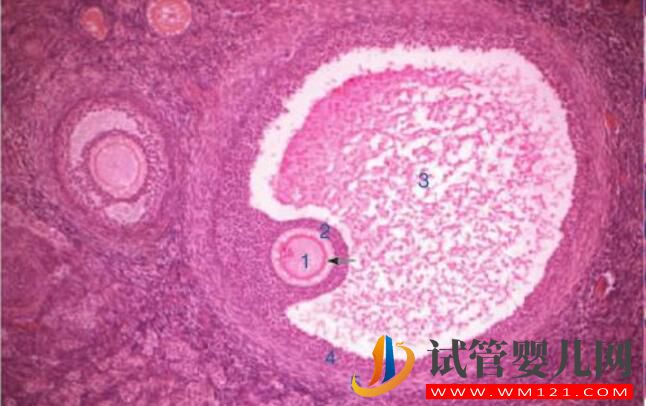 试管婴儿为什么取出空卵泡？何避免“空卵泡”现象