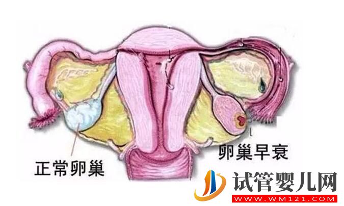 高龄女性卵巢功能低，试管手术可以做吗