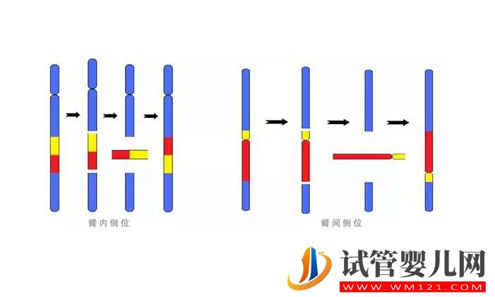 染色体平衡易位能做试管手术吗 要注意哪些问题