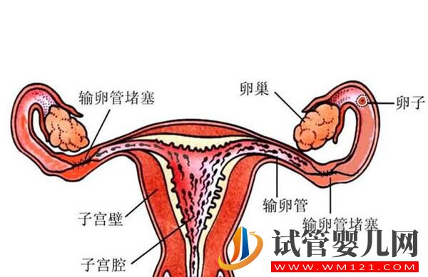 输卵管积水会对试管婴儿成功率造成影响吗?