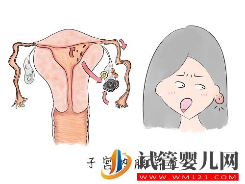 子宫内膜异位症——痛经的一种常见病因(图2)